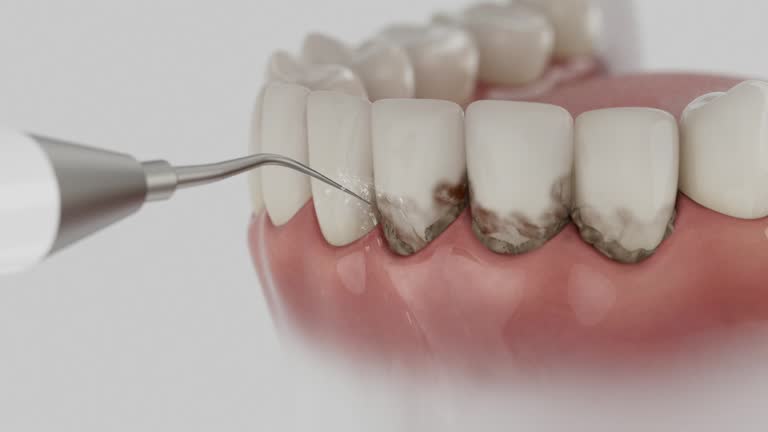 Reliable Dental contractor in Andrews, IN by Dentist Open Now